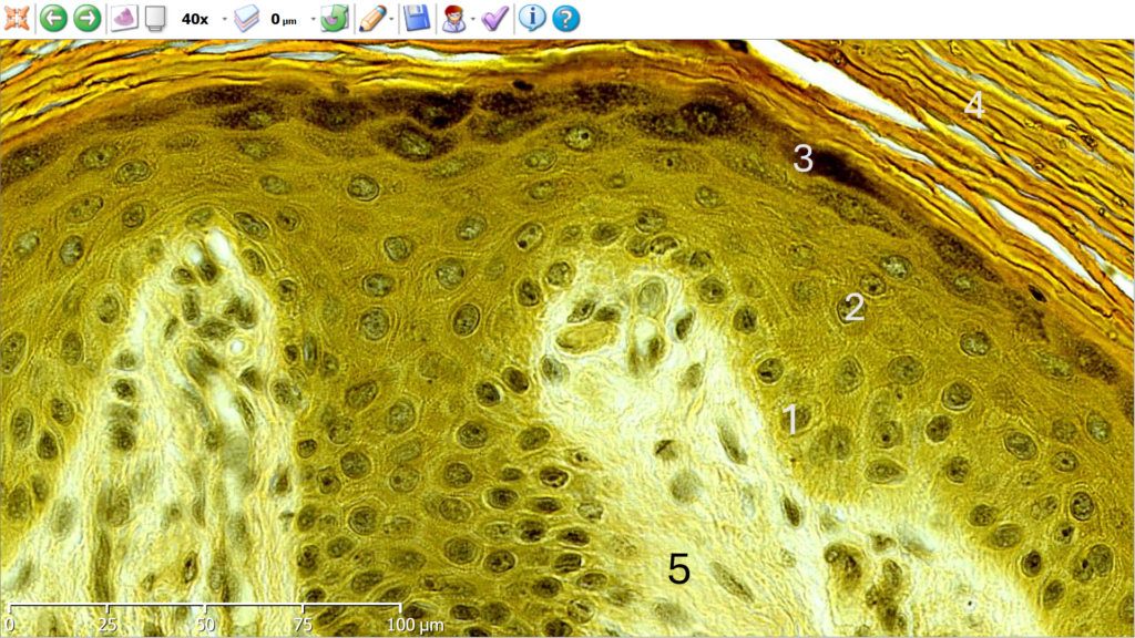 Corte de piel delgada. Tinción tricrómica tipo Van Gieson modificada