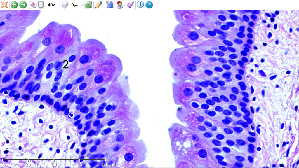Corte de vejiga. Tinción Hematoxilina-Eosina.