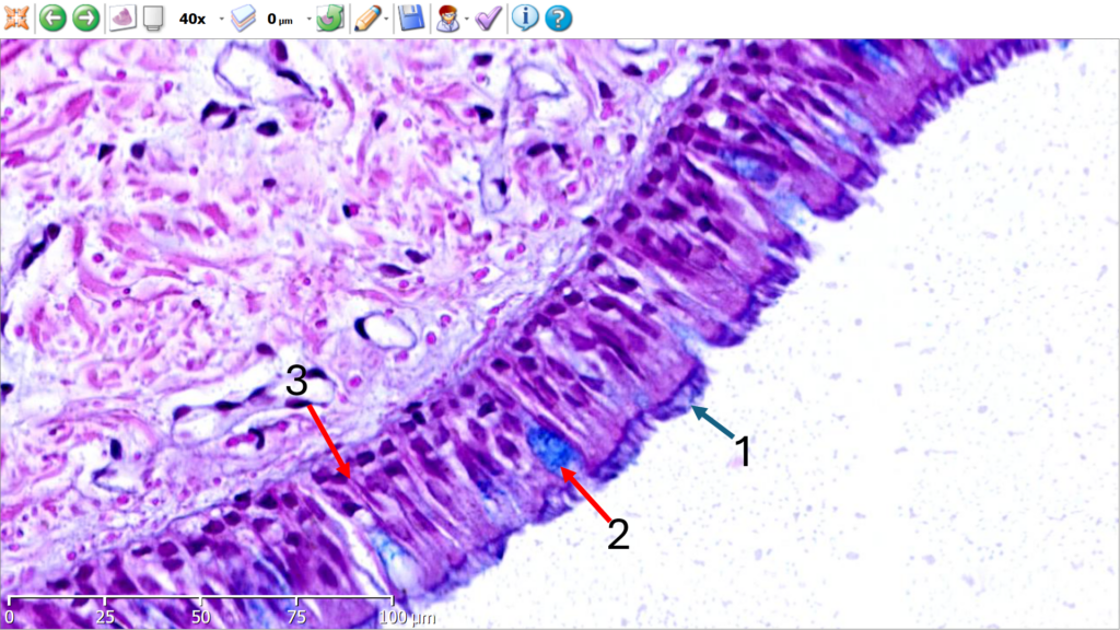 Epitelio respiratorio. Tinción H-E / Azul de Alcian